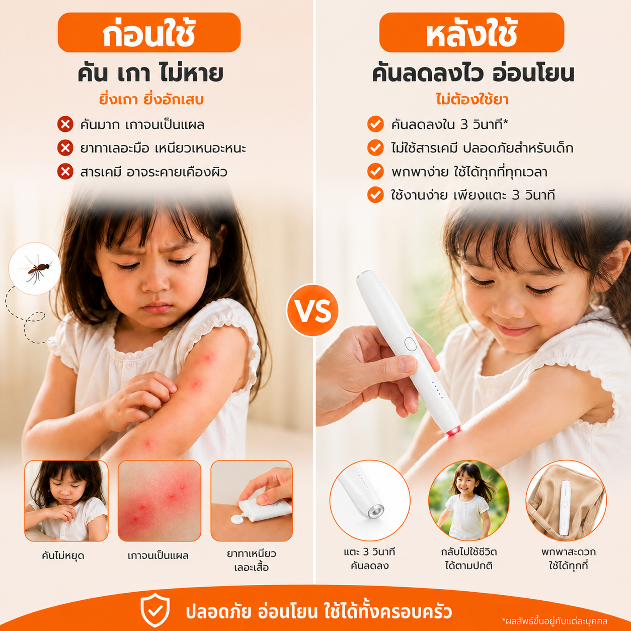 Keero ปากกาบรรเทาอาการคันจากเเมลง
