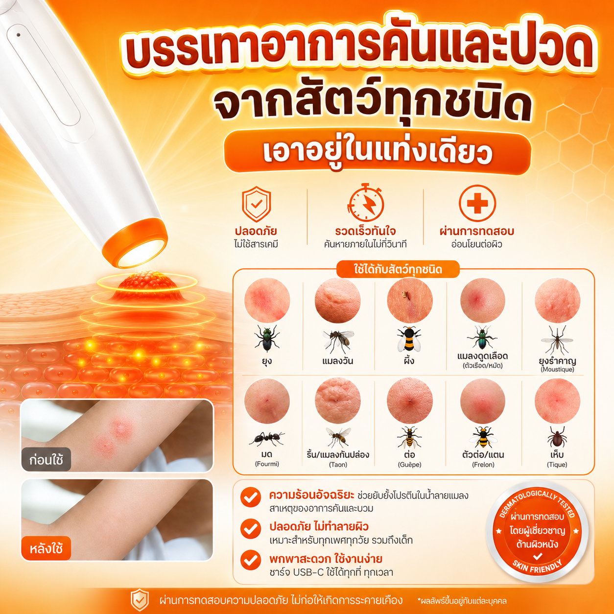 Keero ปากกาบรรเทาอาการคันจากเเมลง