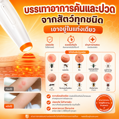 Keero ปากกาบรรเทาอาการคันจากเเมลง